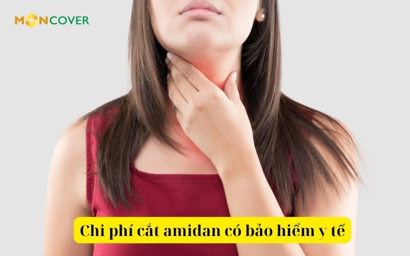 Chi phí cắt amidan có bảo hiểm y tế