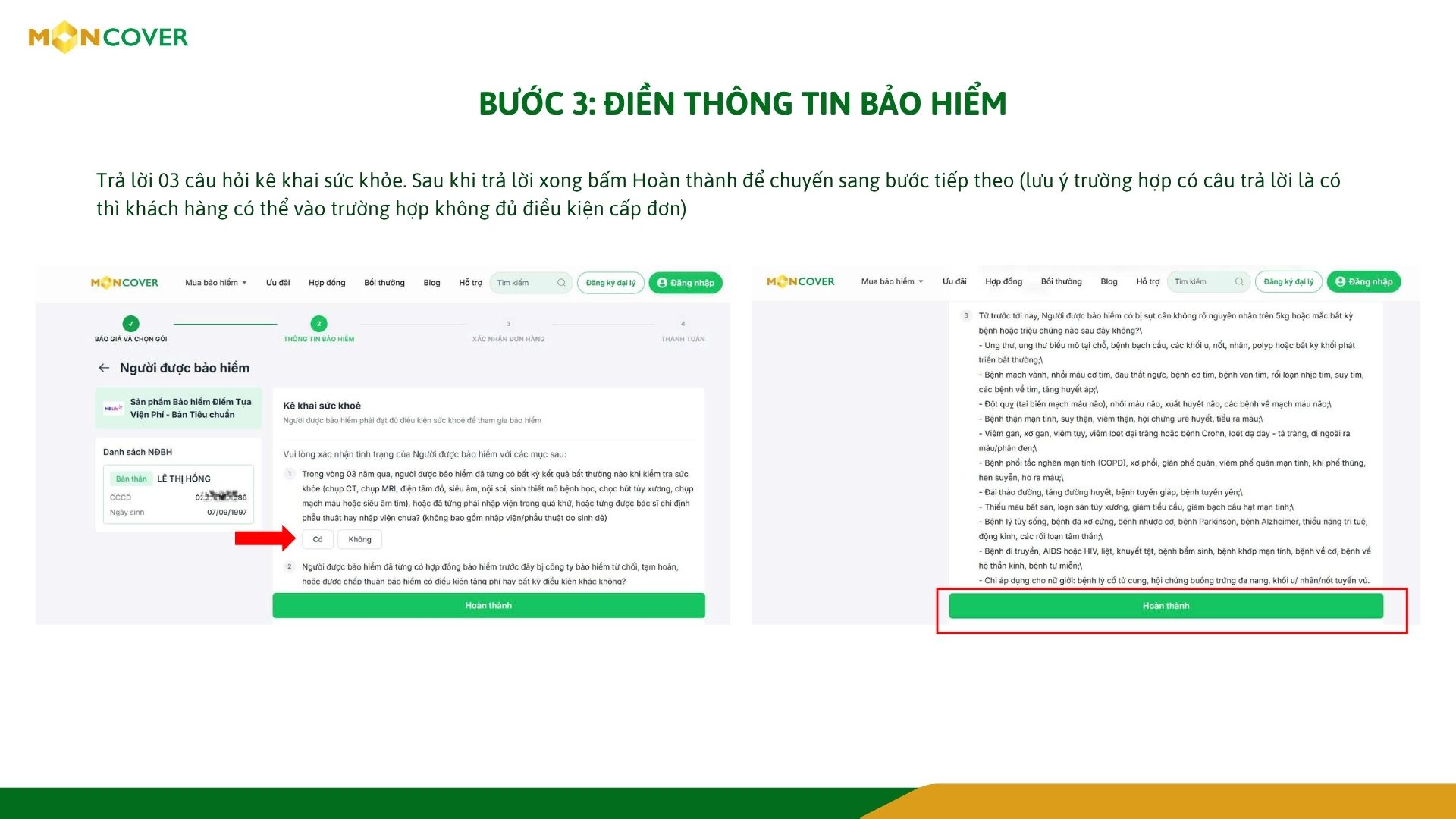 Hướng dẫn cấp đơn Sản phẩm bảo hiểm y tế mở rộng Điểm tựa viện phí