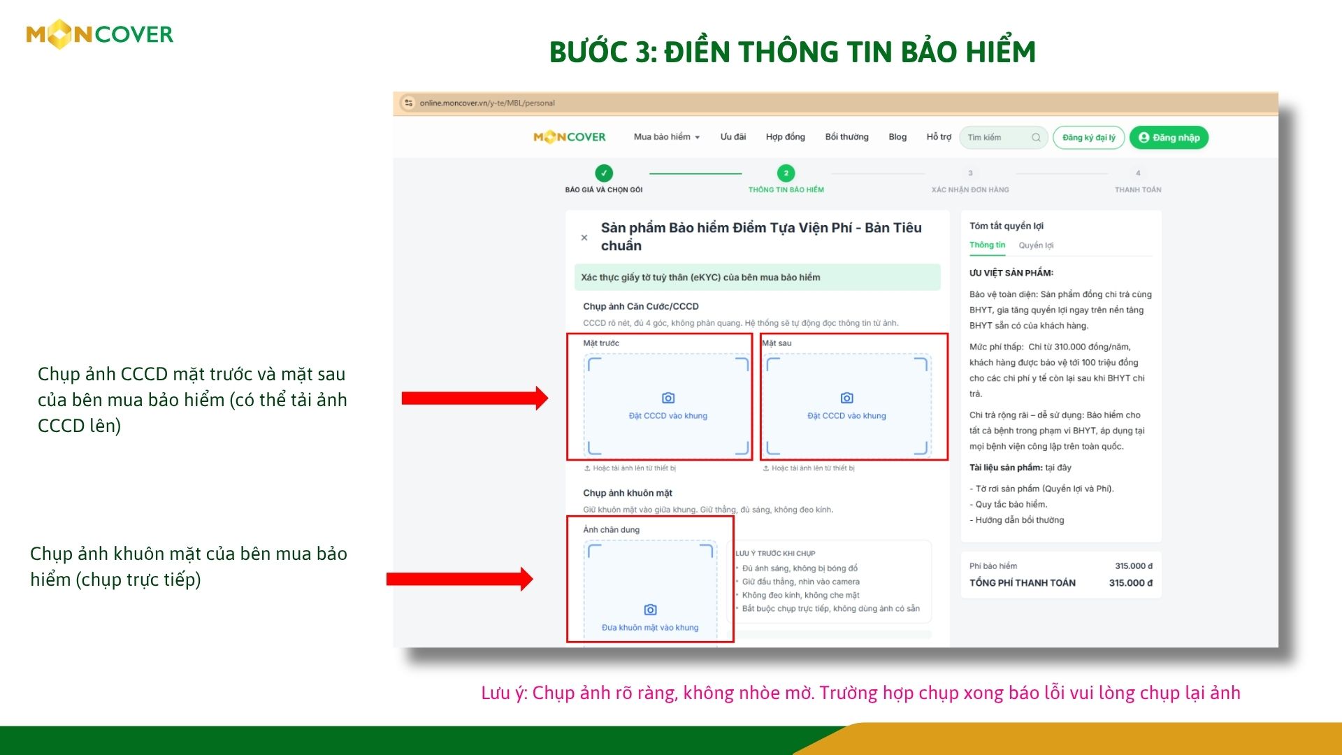 Hướng dẫn cấp đơn Sản phẩm bảo hiểm y tế mở rộng Điểm tựa viện phí